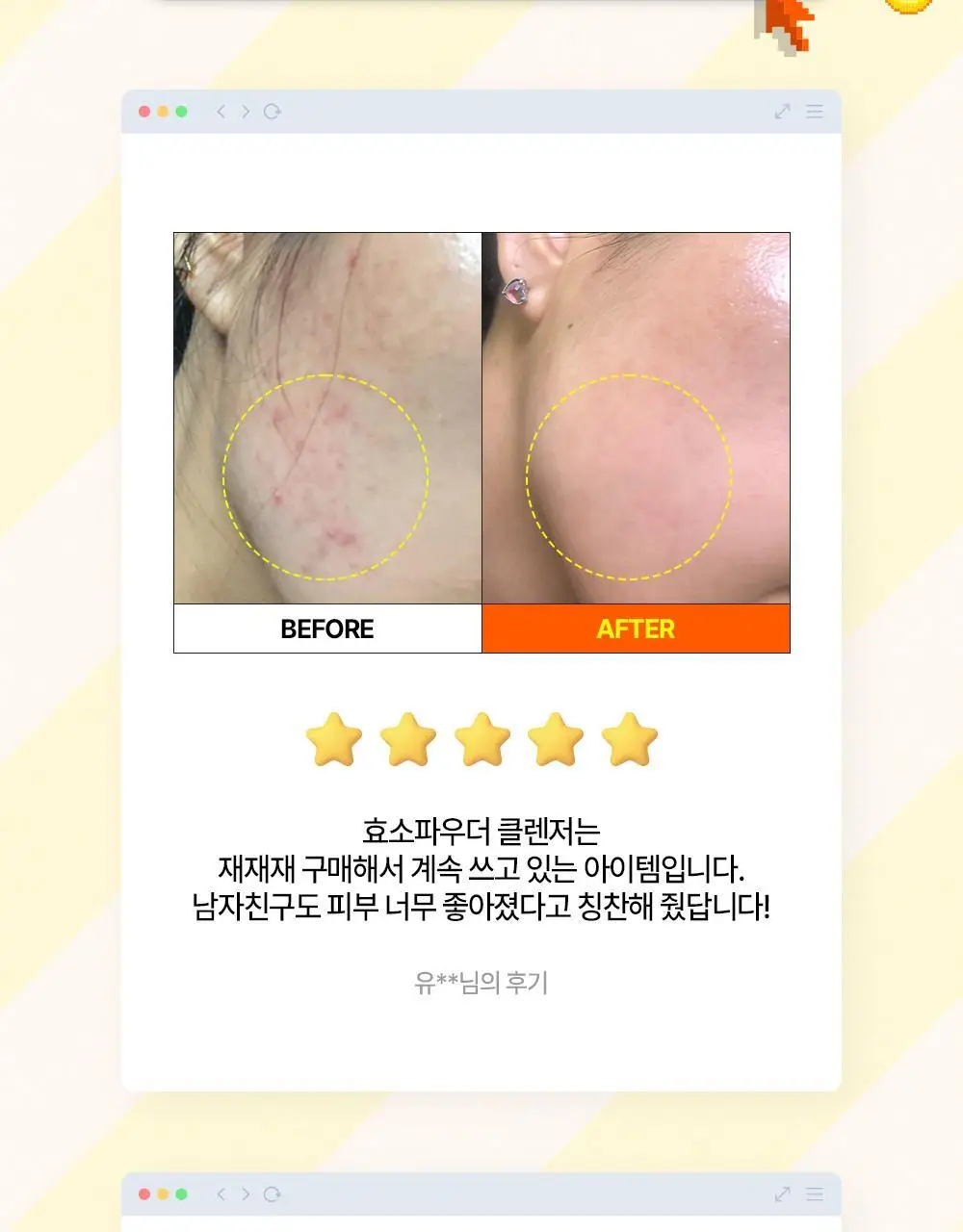 [온라인 단독] 파파레서피 블레미쉬 효소 파우더 클렌저 50g 더블기획 (+브러쉬+블레미쉬 크림 7ml) 상세페이지 6